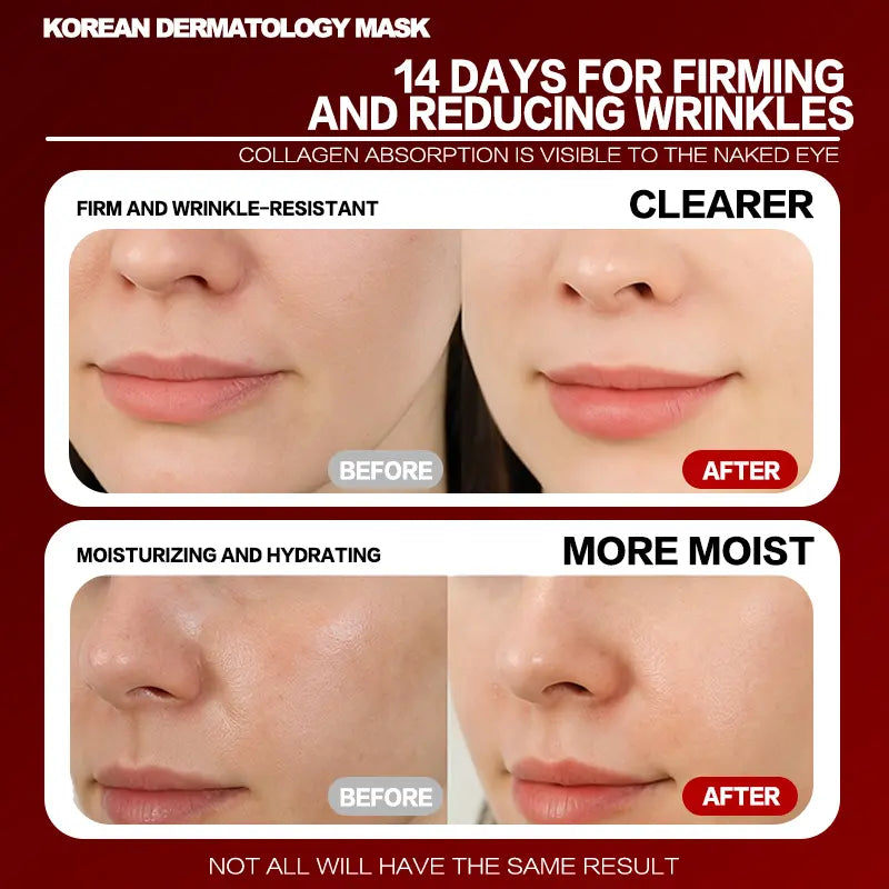 Redgate Korean Dermatology Luminous Collagen Mask (9Ea) |Deep Collagen Power Boosting Mask | Tear-Off Facial Mask for Firm Skin Repair