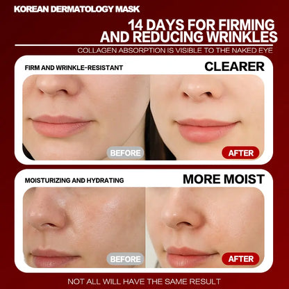 Redgate Korean Dermatology Luminous Collagen Mask (9Ea) |Deep Collagen Power Boosting Mask | Tear-Off Facial Mask for Firm Skin Repair