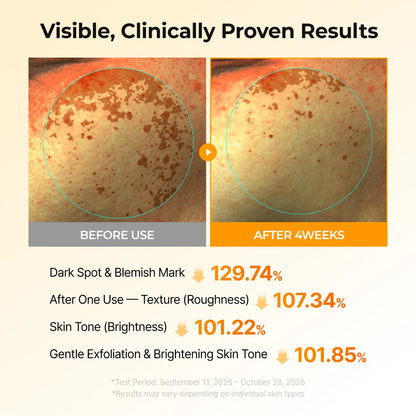 [Dr.Melaxin Official] Kojic Acid Turmeric TX Toner Pad 70Pads, Dark Spot & Pigmentation Care for Uneven Skin Tone